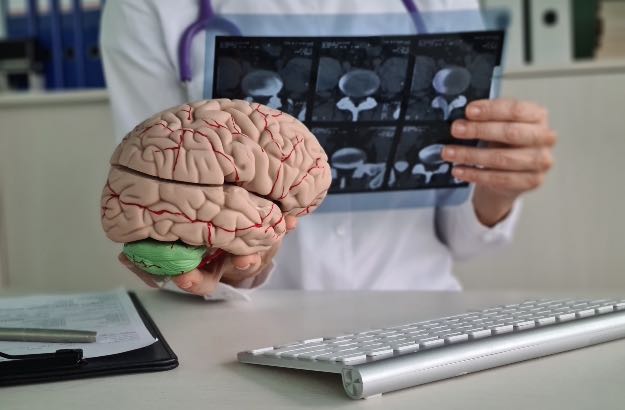 Doutor examia o raio X cérebro humano