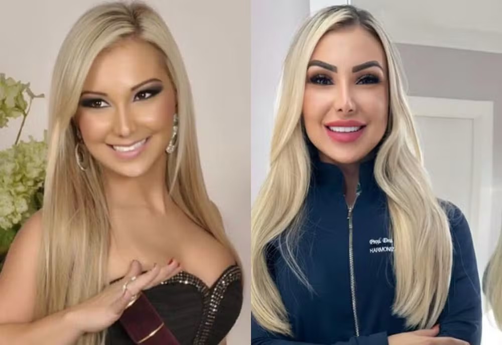 Fernanda Passon antes e depois