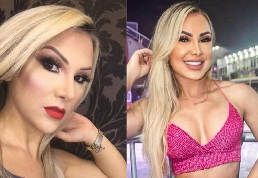 Fernanda Passon antes e depois