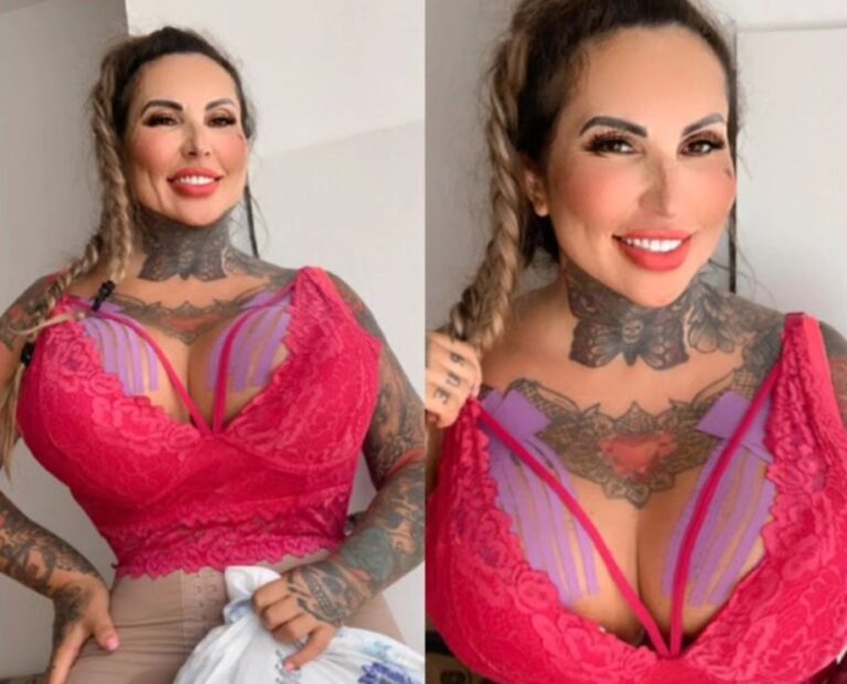 Sabrina Boing Boing mostra antes e depois após colocar 6 litros de ...