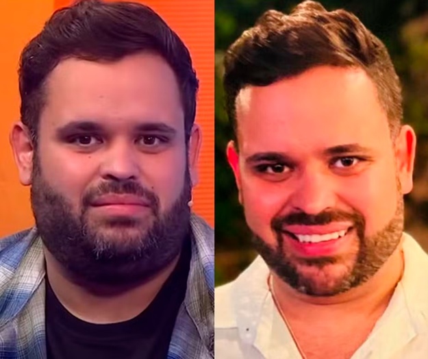 Antes e depois Michel BBB24