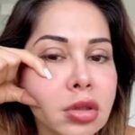 Maíra Cardi passará por cirurgia após procedimento malsucedido no rosto e diz que não pode engravidar