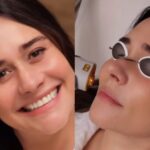 Alessandra Negrini detalha procedimento estético para rejuvenescimento: "Tratamento de beleza favorito"