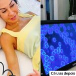 Grávida, Maira Cardi faz tratamento alternativo para células; conheça