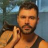 Rodrigo Sant’Anna volta atrás e reverte procedimentos estéticos: "Harmonizado consciente"