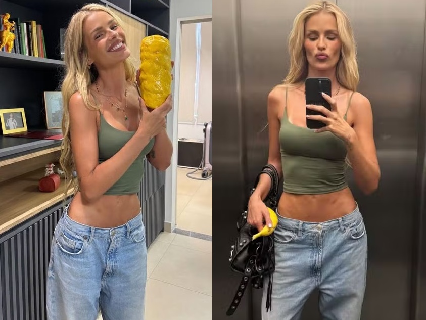 Yasmin Brunet mostra o corpo após tratamento para lipodema e rebate haters
