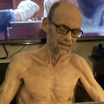 Ex-fisiculturista perde 22 kg após ter sintomas de doença ignorados por médicos