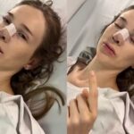 Sammy diz ter realizado mais de quatro cirurgias no nariz: "Destruíram minha respiração"