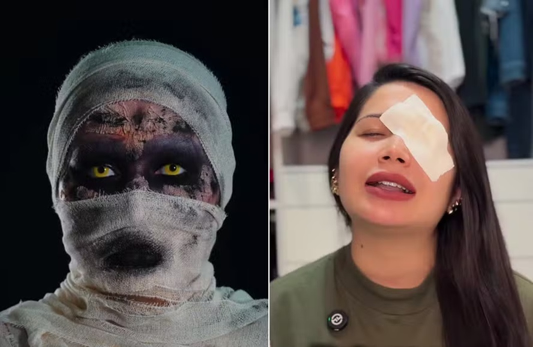 Influencer sofre hemorragia ocular após usar lente vencida em trend de maquiagem
