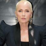 Xuxa explica decisão de fazer transplante capilar após alopecia androgenética