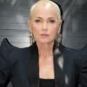 Xuxa explica decisão de fazer transplante capilar após alopecia androgenética