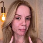 Influencer Bruna Paludetti surge com rosto desfigurado após procedimento estético dar errado