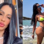 Influencer diz que procedimento estético foi motivo de separação: 'Se sentiu traído'