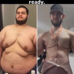 Influencer emagrece 150 kg e retira 7 kg de excesso de pele; compare Influencer emagrece 150 kg e retira 7 kg de excesso de pele; compare