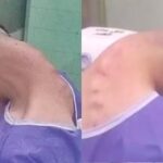 Síndrome da cabeça caída: homem viraliza após mostrar pescoço 'dobrado'