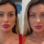 Andressa Urach se arrepende de corurgia para mudança definitiva da cor dos olhos Andressa Urach se arrepende de corurgia para mudança definitiva da cor dos olhos