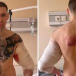 'Popeye' russo é hospitalizado para retirada de bíceps; entenda o caso 'Popeye' russo é hospitalizado para retirada de bíceps; entenda o caso