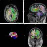 Mais músculos e menos gordura abdominal podem retardar o envelhecimento cerebral